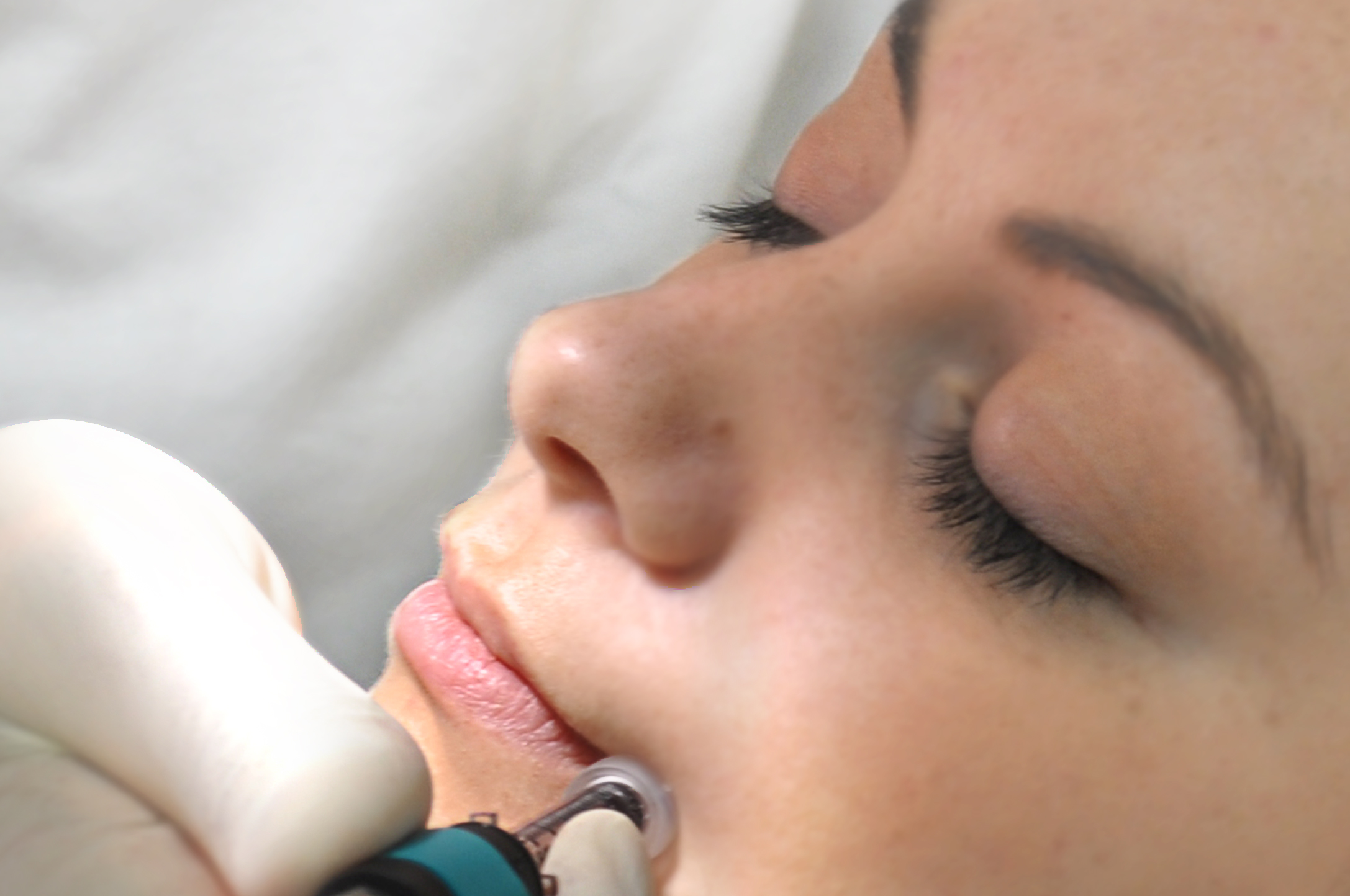 PoreJet Needle-Free Wrinkle Treatment comes to The Abbeyfields